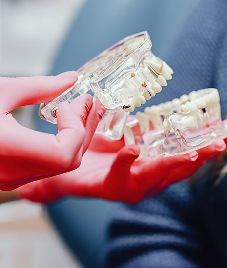 Protetik Diş Tedavisi