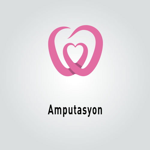 Amputasyon