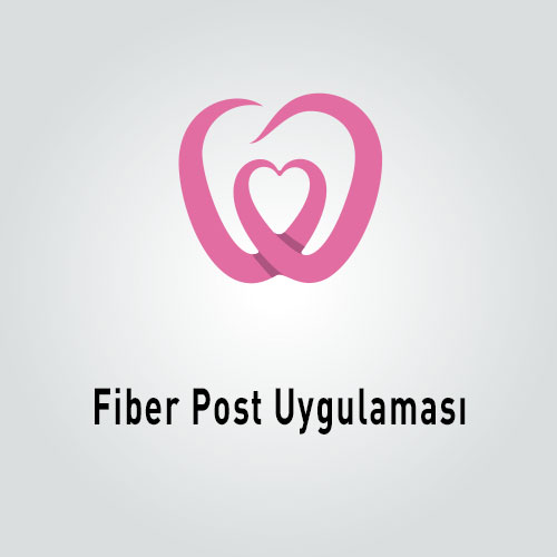 Fiber Post Uygulaması