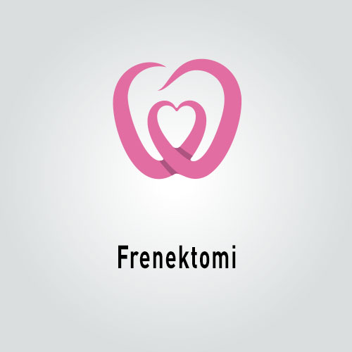Frenektomi