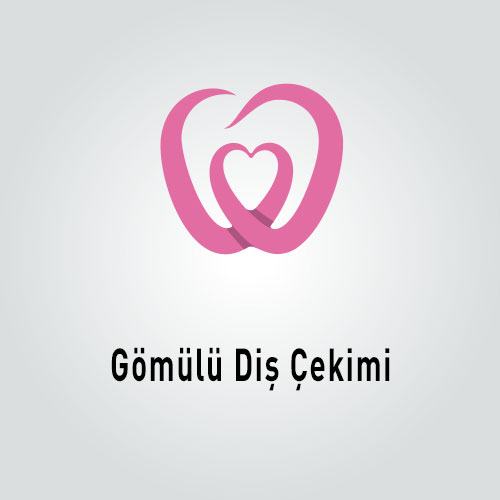 Gömülü Diş Çekimi