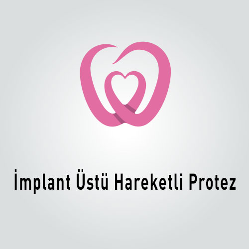İmplant Üstü Hareketli Protez