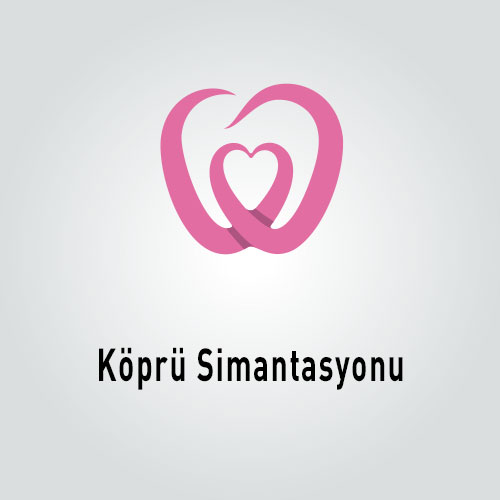 Köprü Simantasyonu