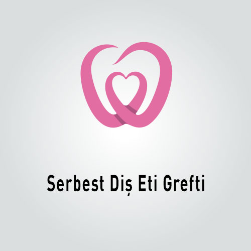 Serbest Diş Eti Grefti